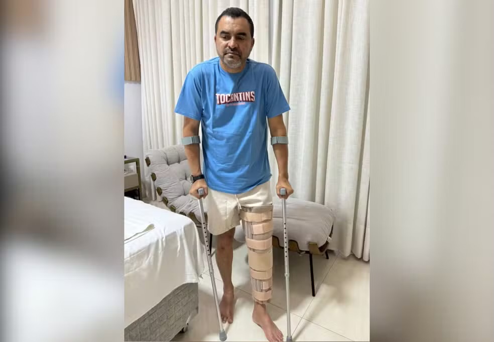 Governador do Tocantins sofre lesão no joelho e precisará de cirurgia
